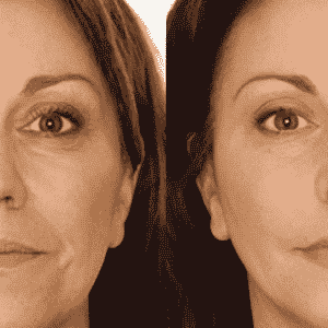 tratamente cu oxigen