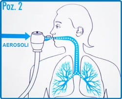 Concentrator Oxigen Medical