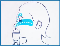 Concentrator Oxigen Medical